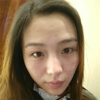 光子嫩膚和下巴脂肪填充術(shù)后果圖片分享，董萍門診做的~