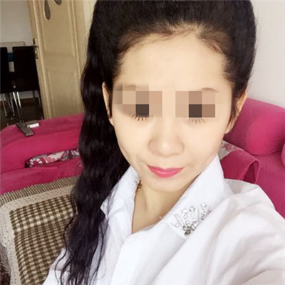 玻尿酸填充淚溝恢復(fù)過程和前后對比果圖片分享~