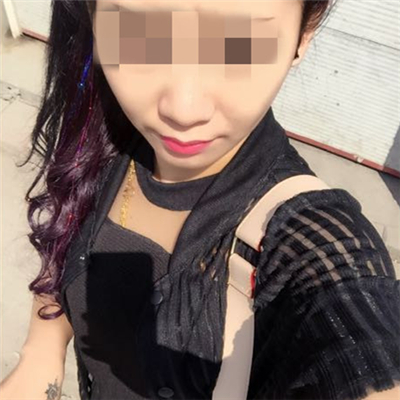 玻尿酸填充淚溝恢復(fù)過程和前后對比果圖片分享~