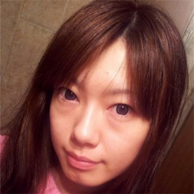 激光溶脂去眼袋恢復過程和前后對比果圖片分享哦~