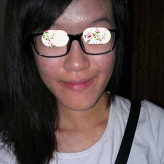 激光祛痘手術(shù)恢復(fù)過(guò)程分享，還有前后對(duì)比果圖片哦~