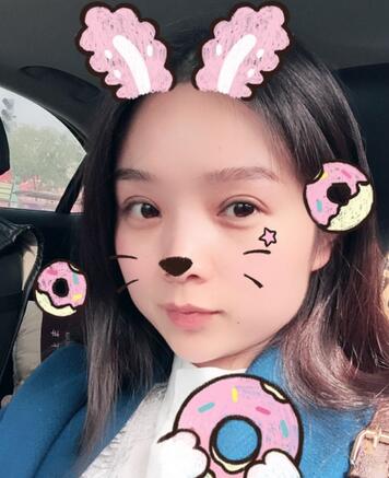 全切雙眼皮1個月過程圖