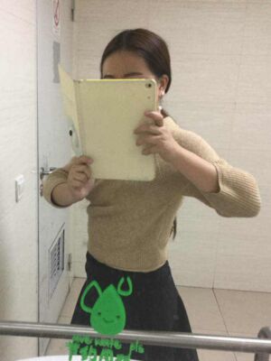 腰腹吸脂減肥果很好，恢復圖分享