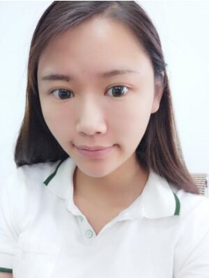 自體脂肪面部填充后恢復(fù)，成活率還蠻高的