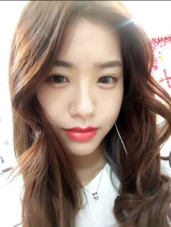 玻尿酸豐下巴果還不錯(cuò) 過幾個(gè)月就做假體隆下巴