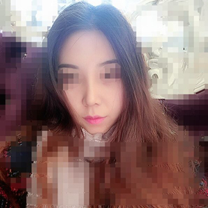 吸脂瘦臉手術(shù)半年了，分享前后對(duì)比果照片~