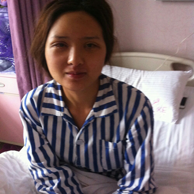 雙眼皮手術(shù)前后對(duì)比果照片分享，北京美萊做的~