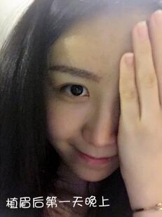 眉毛種植價(jià)格4800元,植眉果和成長(zhǎng)過(guò)程分享