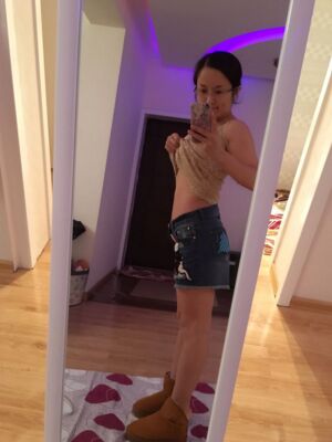 腰腹吸脂整形對(duì)比圖 肚子小了很多