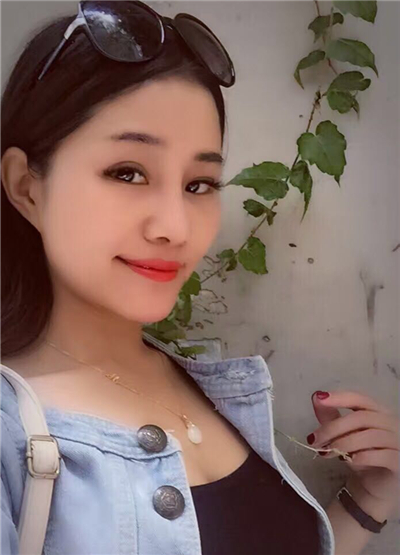 我做自體脂肪隆鼻手術(shù)恢復(fù)過程和前后對(duì)比果圖片分享哦~