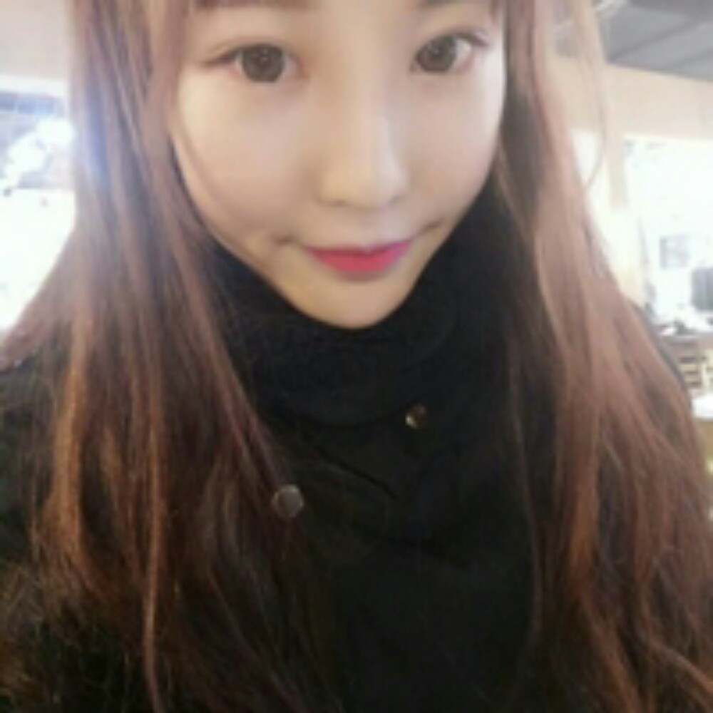 耳軟骨隆鼻尖+自體脂肪填充全臉恢復(fù)前后對比果照片分享~