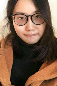 下頜角切除手術(shù)之后，我也變成小V臉了!