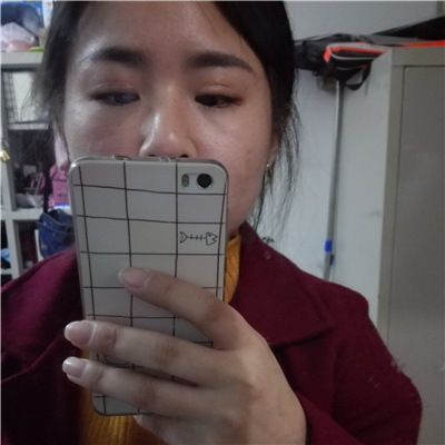 注射瘦臉去魚尾紋恢復過程和前后對比果圖片分享，上海東方做的~