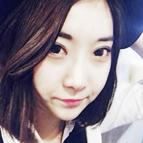 米蘭柏羽做了外切去眼袋，分享手術(shù)前后對比果圖片哦~