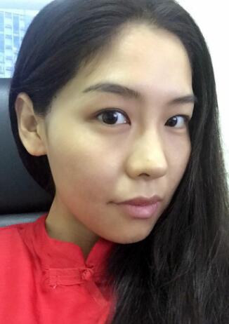 做埋埋蛋白線.提升手術(shù)