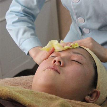 激光去雀斑前后對(duì)比果圖片分享，福州海峽林瓏醫(yī)生做的~