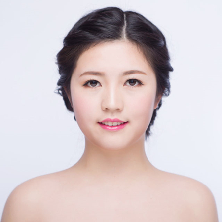 激光去雀斑前后對(duì)比果圖片分享，福州海峽林瓏醫(yī)生做的~