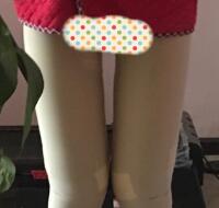 今年去做了大腿吸脂減肥手術(shù)，吸脂果挺好的