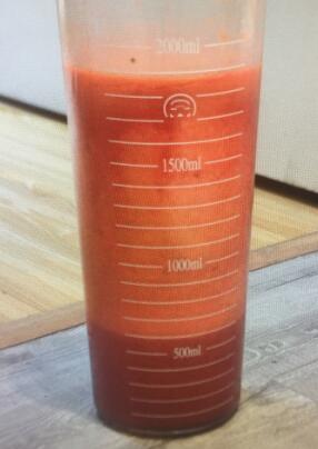 吸脂減肥手術(shù)抽出這么多大腿脂肪