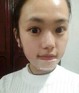 硅膠假體墊下巴整形手術(shù)后的這幾天