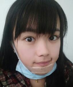 硅膠假體墊下巴整形