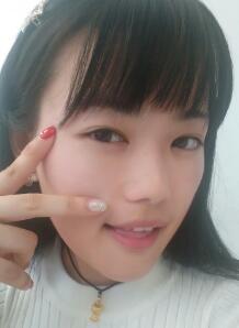 硅膠假體墊下巴拆線了