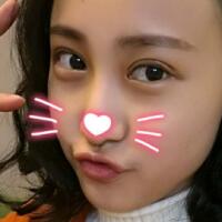 割雙眼皮恢復(fù)過程分享，整形價格3800元