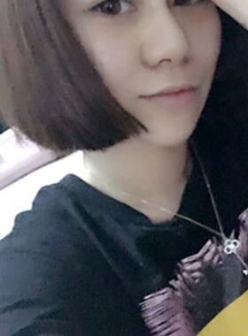 隆鼻整形前后對比照片 果是不是很好呀