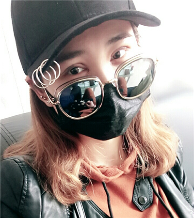 開內(nèi)眼角+切開雙眼皮前后對比果圖片分享，青島金島韓勝醫(yī)生做的~