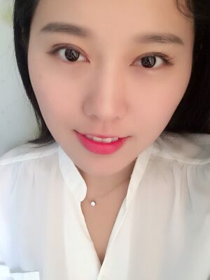 雙眼皮失敗修復(fù)手術(shù)恢復(fù)超自然，看起來一點都不假