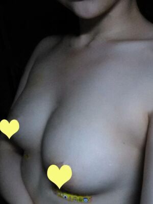 自體脂肪隆胸后胸變得豐滿，腿也細了很多