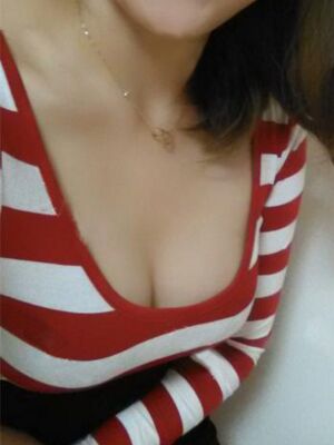 自體脂肪隆胸后胸變得豐滿，腿也細了很多