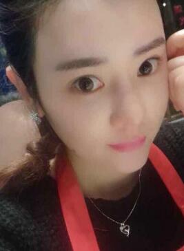 自體脂肪豐太陽穴一個月了