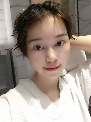 點(diǎn)陣激光祛痘前后過程對比照片分享，大家來看看果怎么樣