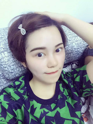 點(diǎn)陣激光祛痘前后過程對比照片分享，大家來看看果怎么樣