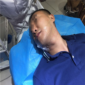 高強(qiáng)度聚焦超聲除掉小細(xì)紋，不再是女人的專*，我也可以擁有!!!