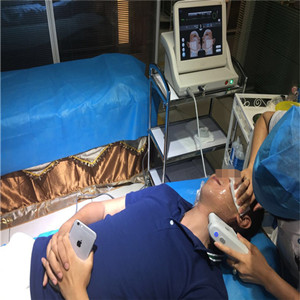 高強(qiáng)度聚焦超聲除掉小細(xì)紋，不再是女人的專*，我也可以擁有!!!