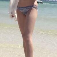 大腿吸脂減肥整形恢復經(jīng)歷分享，吸脂果不錯