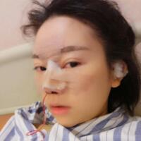 鼻子整形價格10000元，隆鼻手術(shù)過程圖分享