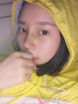 鼻子整形術(shù)后一周了,終于拆線