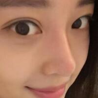 為什么大家覺得隆鼻恐怖，我就做了玻尿酸隆鼻，過程經(jīng)歷分享