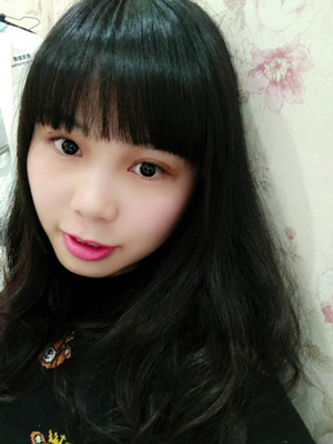 開內(nèi)眼角+雙眼皮手術(shù)后，我也變成大眼睛妹紙了