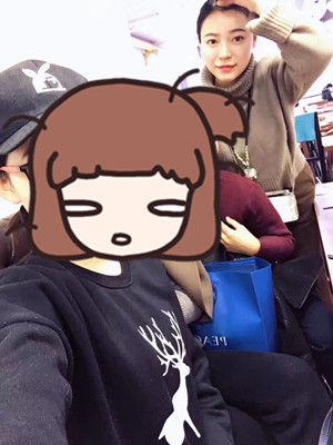 去年12月做的自體脂肪填充蘋果肌，大家來看看果怎么樣?