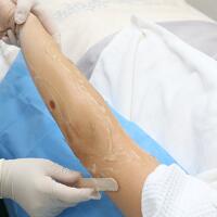 從小我就毛發(fā)旺盛，做了激光脫毛果圖分享給大家