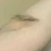 激光脫毛疼嗎？自己做了激光脫毛感覺還好