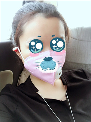 磨下頜角改臉型手術(shù)的變美歷程