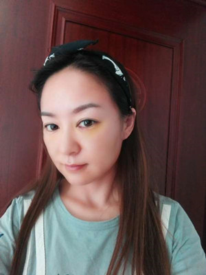 埋埋蛋白線.提升術(shù)之后氣色都變好了喲