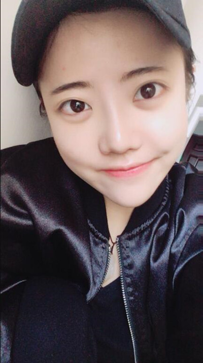 我的隆鼻整形恢復(fù)前后對(duì)果圖 一個(gè)字帥