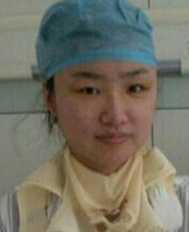 磨下頜骨術(shù)后第4天