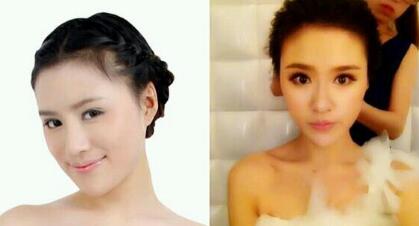 磨骨后下頜角恢復(fù)好后，覺得果很好，我又去做了鼻部整形，墊了下吧